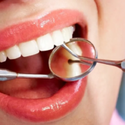 implants-dentaires-en-turquie-840×430
